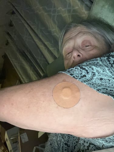 Customer photo review of Skin Grip MAX Freestyle Libre 3 Patches