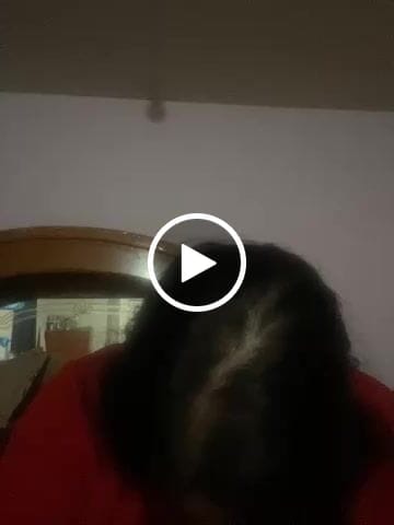 Customer video review of HAIRtamin Fórmula Avanzada