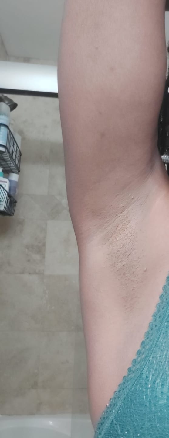Customer photo review of Tinted Deodorant - Light Shade