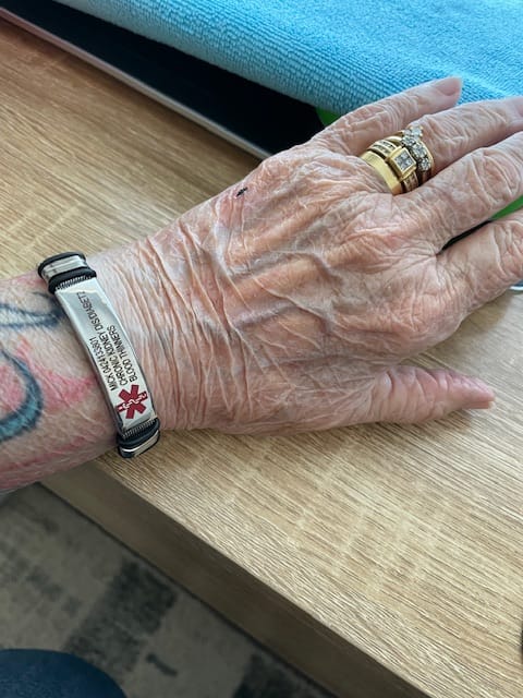 Customer photo review of Personalised Silver Steel Medical Alert ID Mesh Bracelet