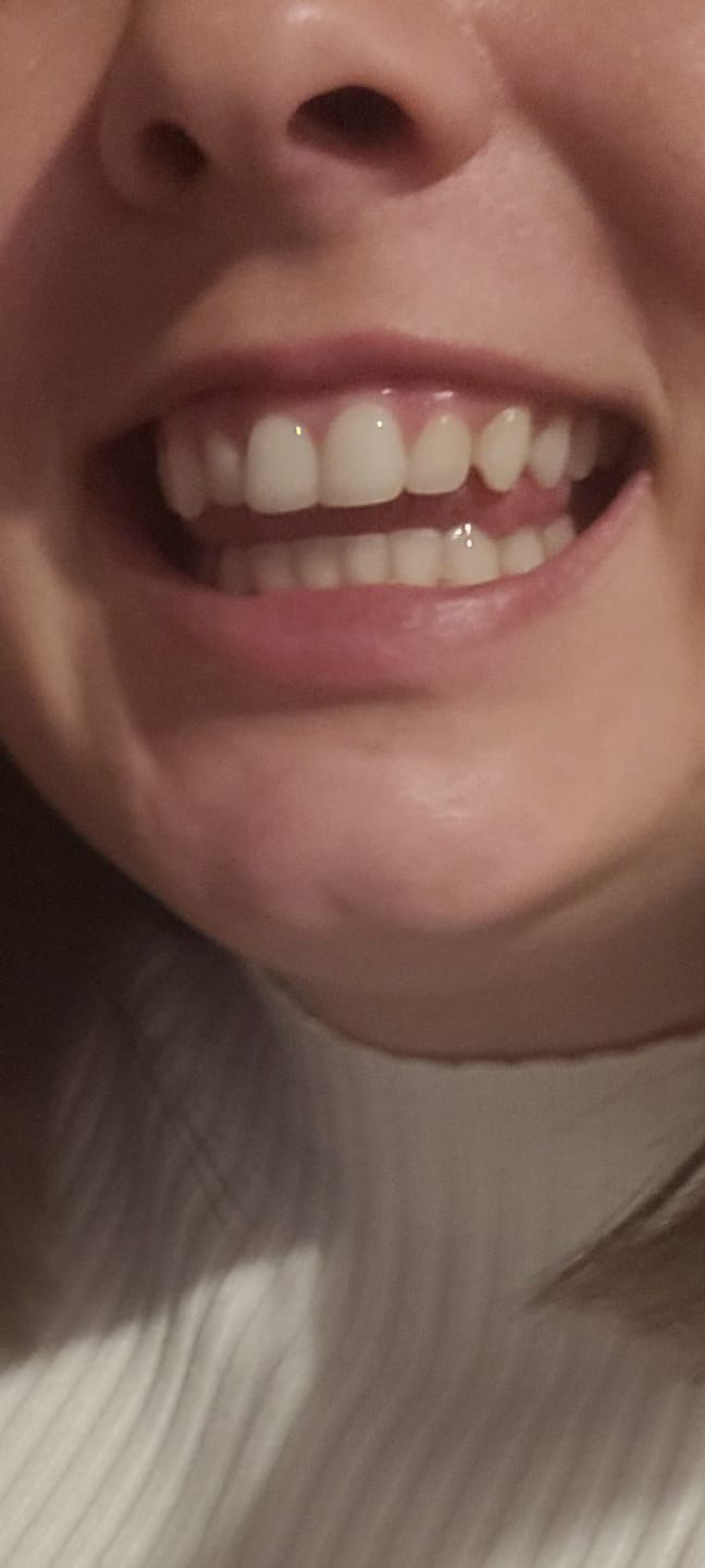 Customer photo review of Gel Violet Blanchissant Kauka Smile