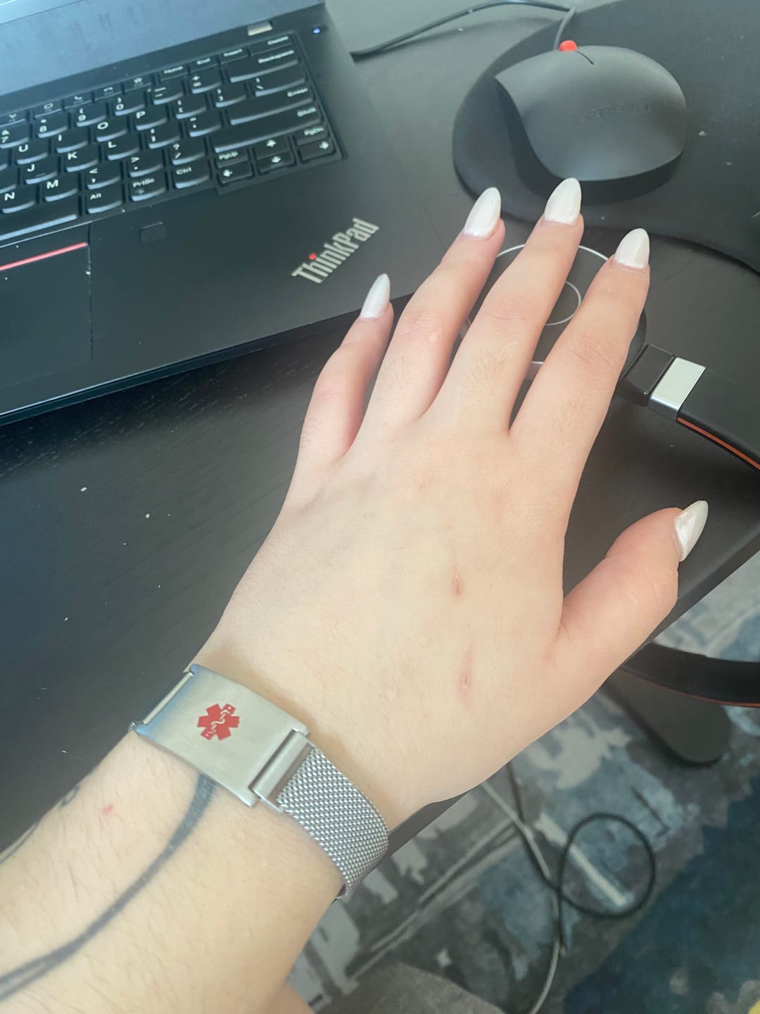 Customer photo review of Roxie Medical Alert Bracelet with Magnetic Closure – Silver Colour