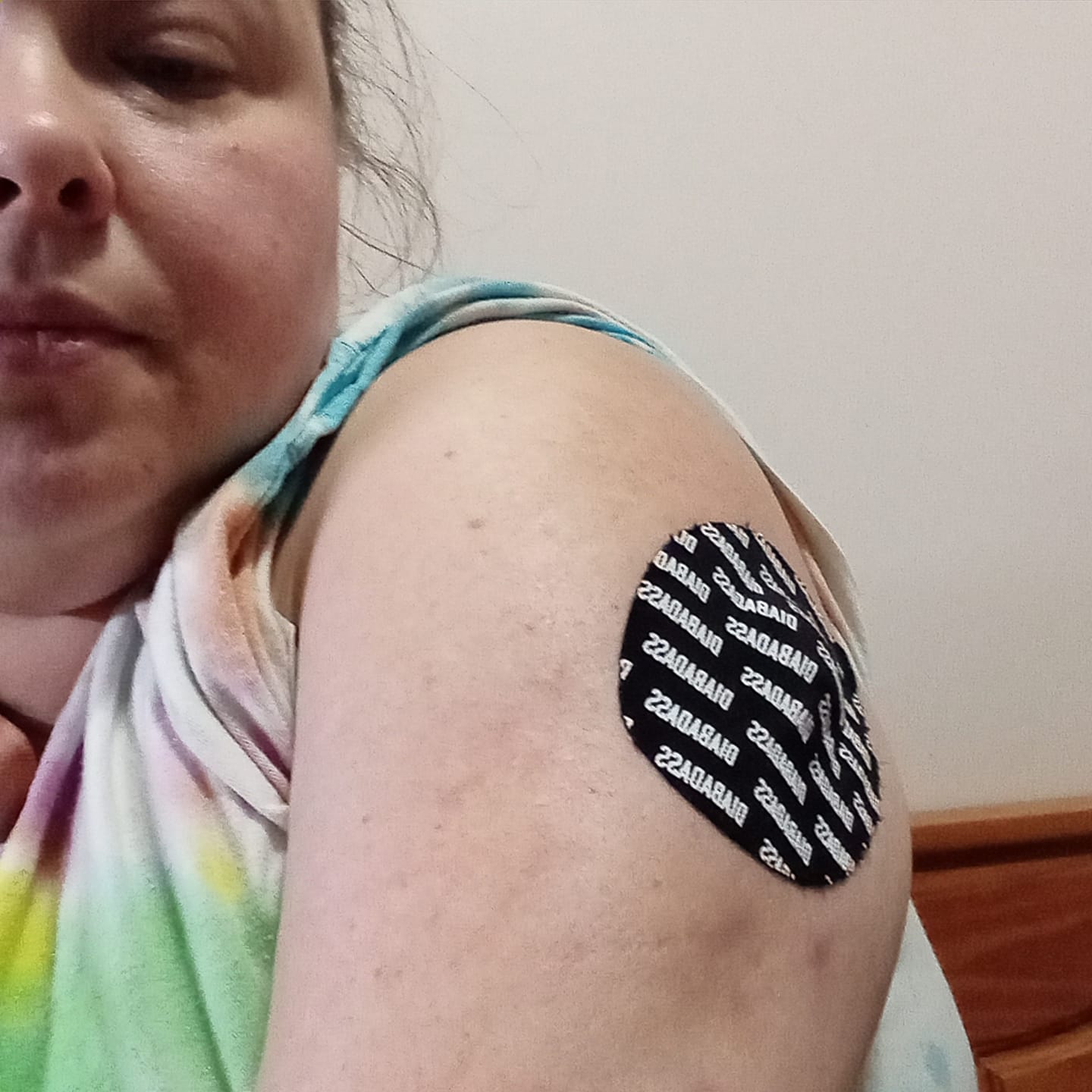 Customer photo review of Skin Grip Original - Medtronic Guardian/Enlite Adhesive Patches