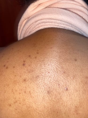 Customer photo review of BLACK SOAP - afrikanische schwarze Seife