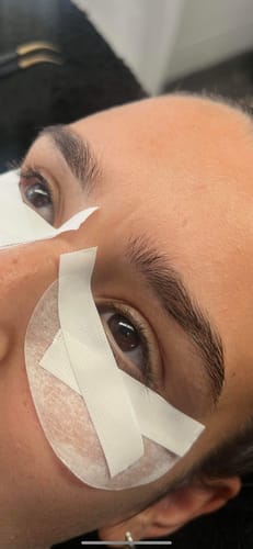 Customer photo review of Breathable Nichiban tape