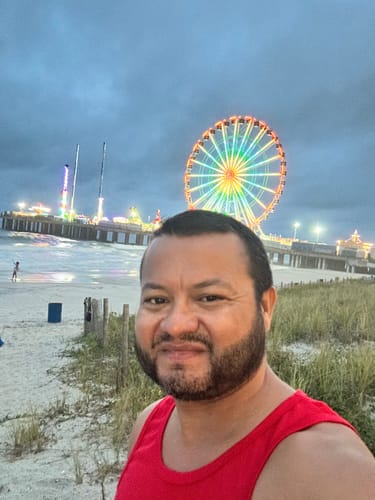 Customer photo review of 10% Minoxytop Minoxidil Extra Strength Topical Solution for Men.