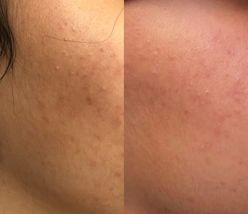 Customer photo review of Gant Exfoliant en soie