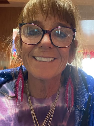 Customer photo review of Pop On Veneers with Impression Kit