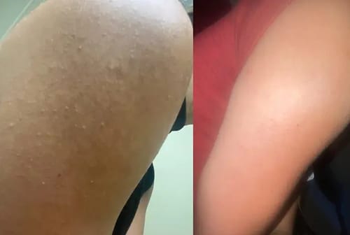 Customer photo review of Gant Exfoliant en soie