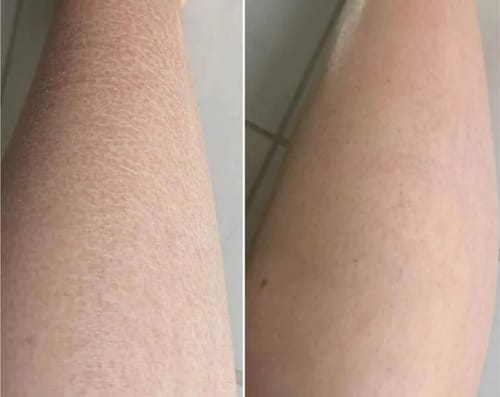 Customer photo review of Gant Exfoliant en soie