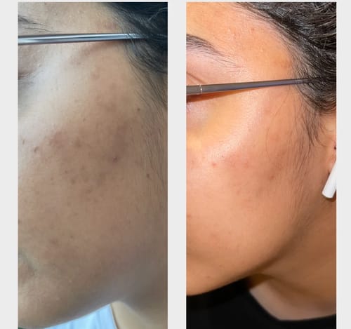 Customer photo review of Gant Exfoliant en soie