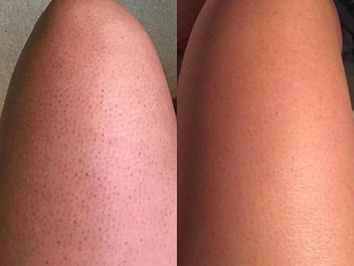 Customer photo review of Gant Exfoliant en soie