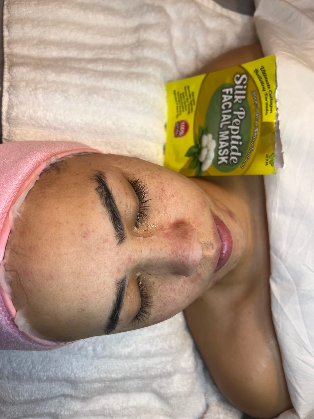 Customer photo review of Velo de Seda de Péptido Mascarilla Facial  100% Natural -  Alto Nivel de Hidratación y Nutrición