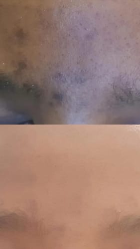 Customer photo review of OceaGlow Marine Collagen