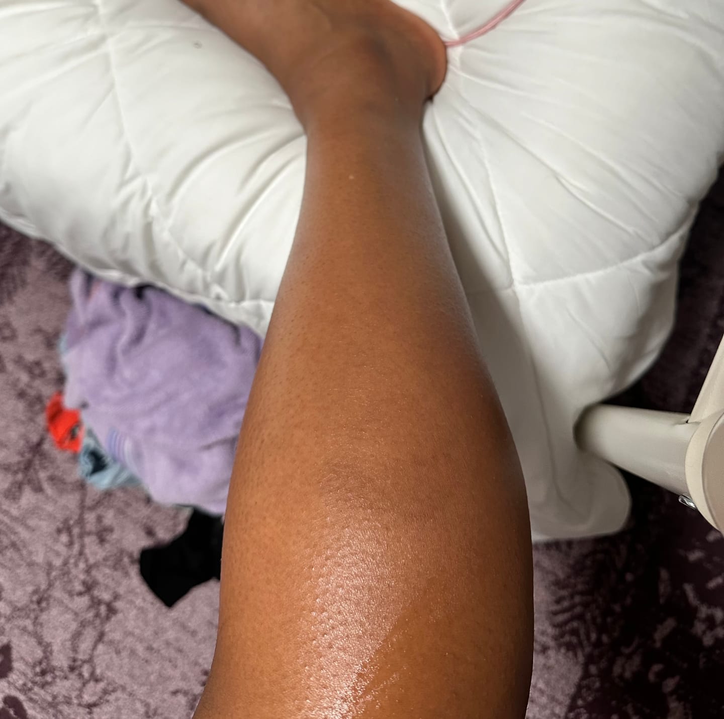 Customer photo review of Magic Eraser Dark Spot Cream