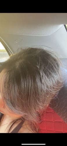 Customer photo review of Rosemary & Castor Oil for Hair Growth