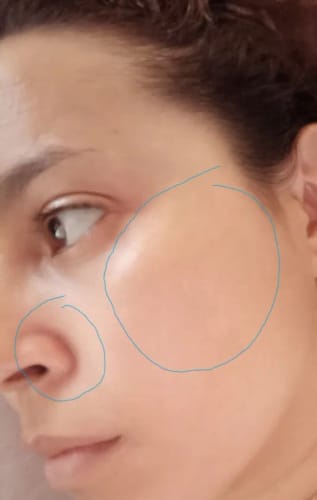 Customer photo review of Sérum Niacinamide Anti taches et acné