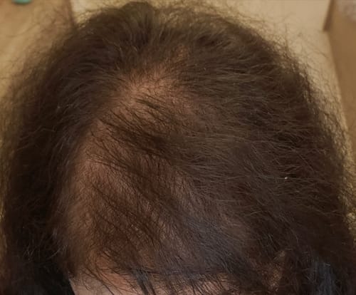 Customer photo review of Growth & Shine Hair Oil