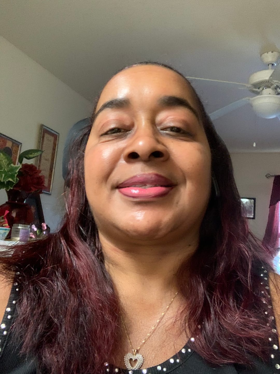 Customer photo review of Fair and White So White Skin Perfector Gel 30ml / 1 fl oz