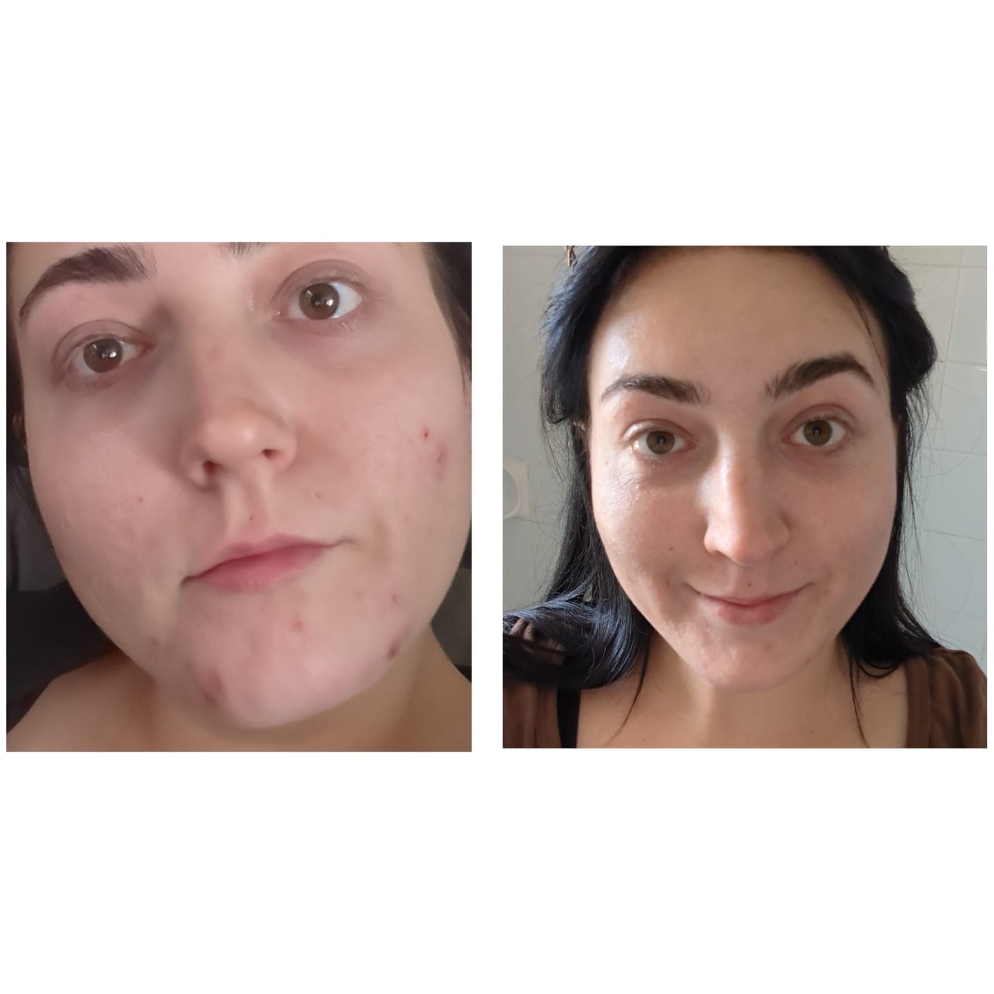Customer photo review of Retinol Night Repair Moisturiser 90ml