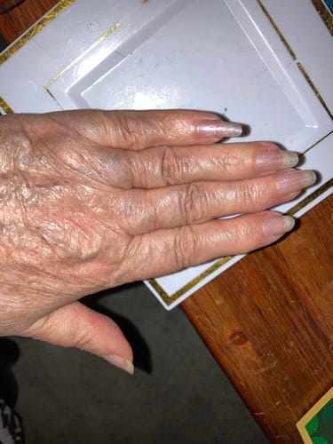 Customer photo review of Rocket Nail Fuel Nail Repair - Clear
