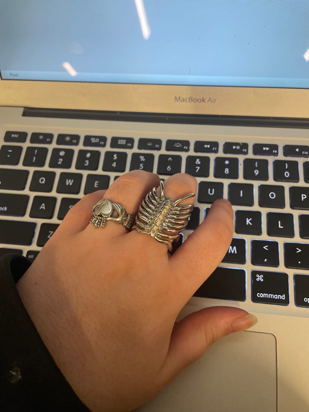 Customer photo review of RIBCAGE RING