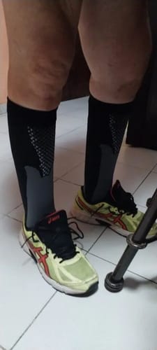 Customer photo review of revitalCare orthopädische Kompressionsstrümpfe