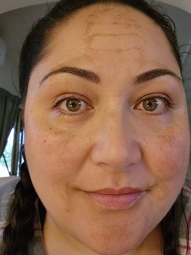 Customer photo review of LOVESKIN Arohanui Facial Serum - Dry/ Mature Skin