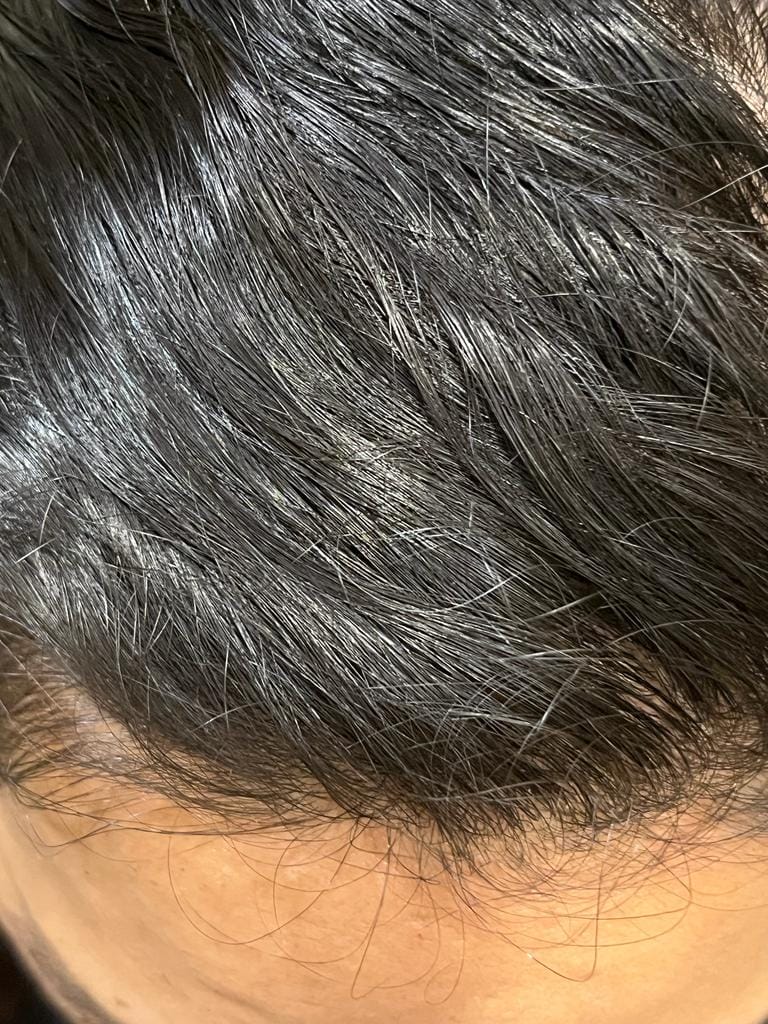 Customer photo review of Dark Brown 3.00 SacredHerbs Botanically Activated Gel Hair Color
