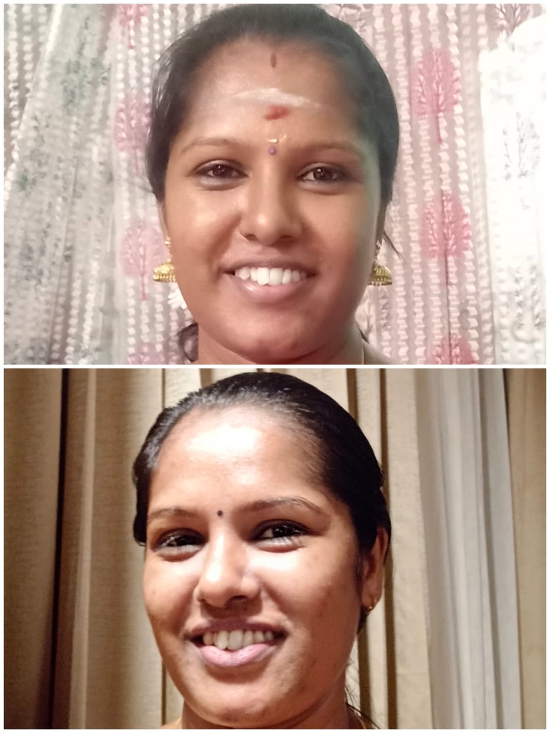 Customer photo review of Hamsa 24K Silver Face Serum (Collagen boosting , anti ageing and Skin brightening)