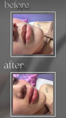 Customer photo review of Scalpa HyaInfuse