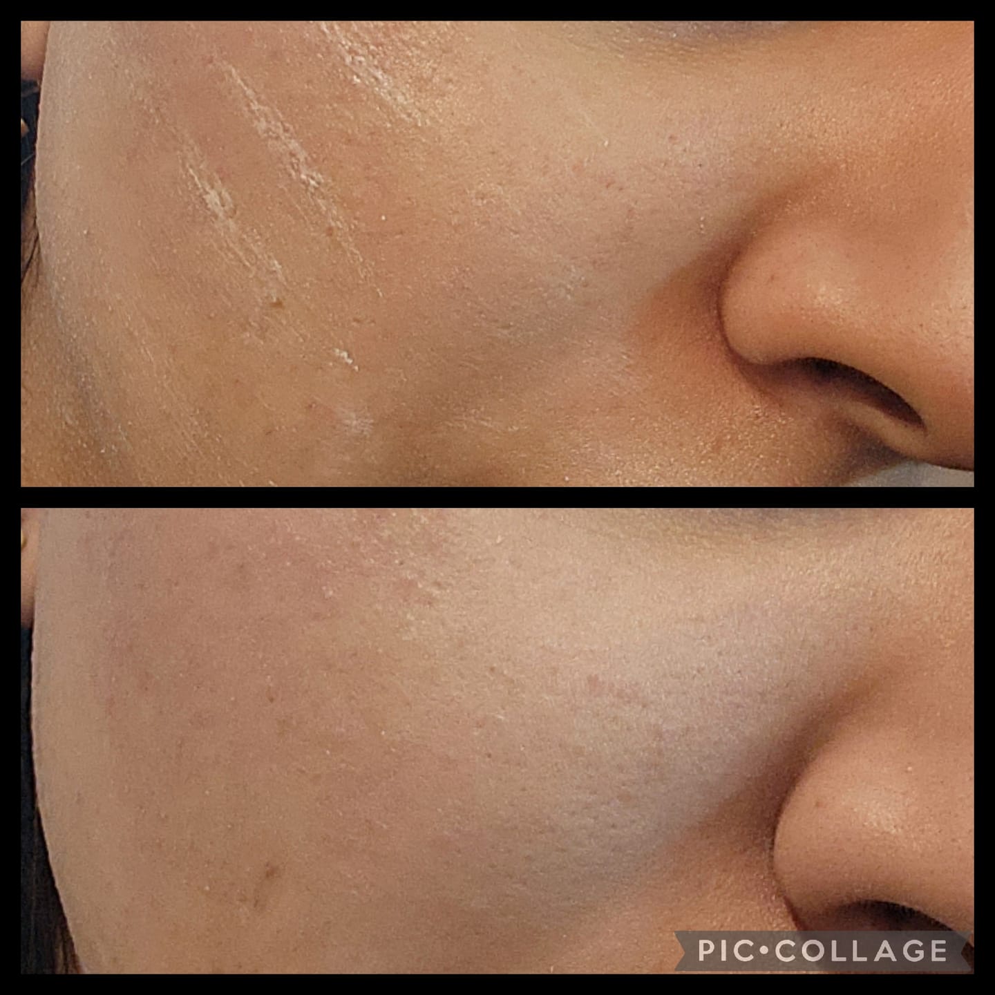 Customer photo review of MATTE SUPERSTICK - SPF 50 PA+++
