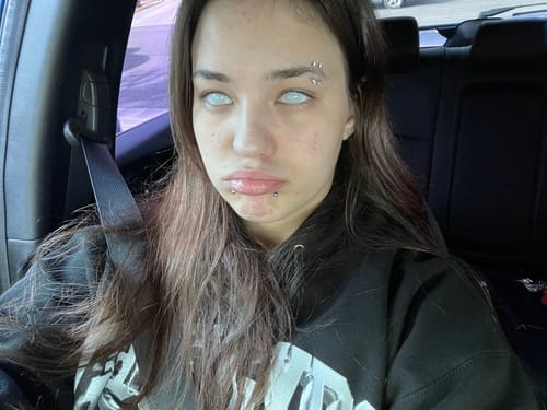 Customer photo review of Cat's Gridding White Contact Lenses(12 months of use)