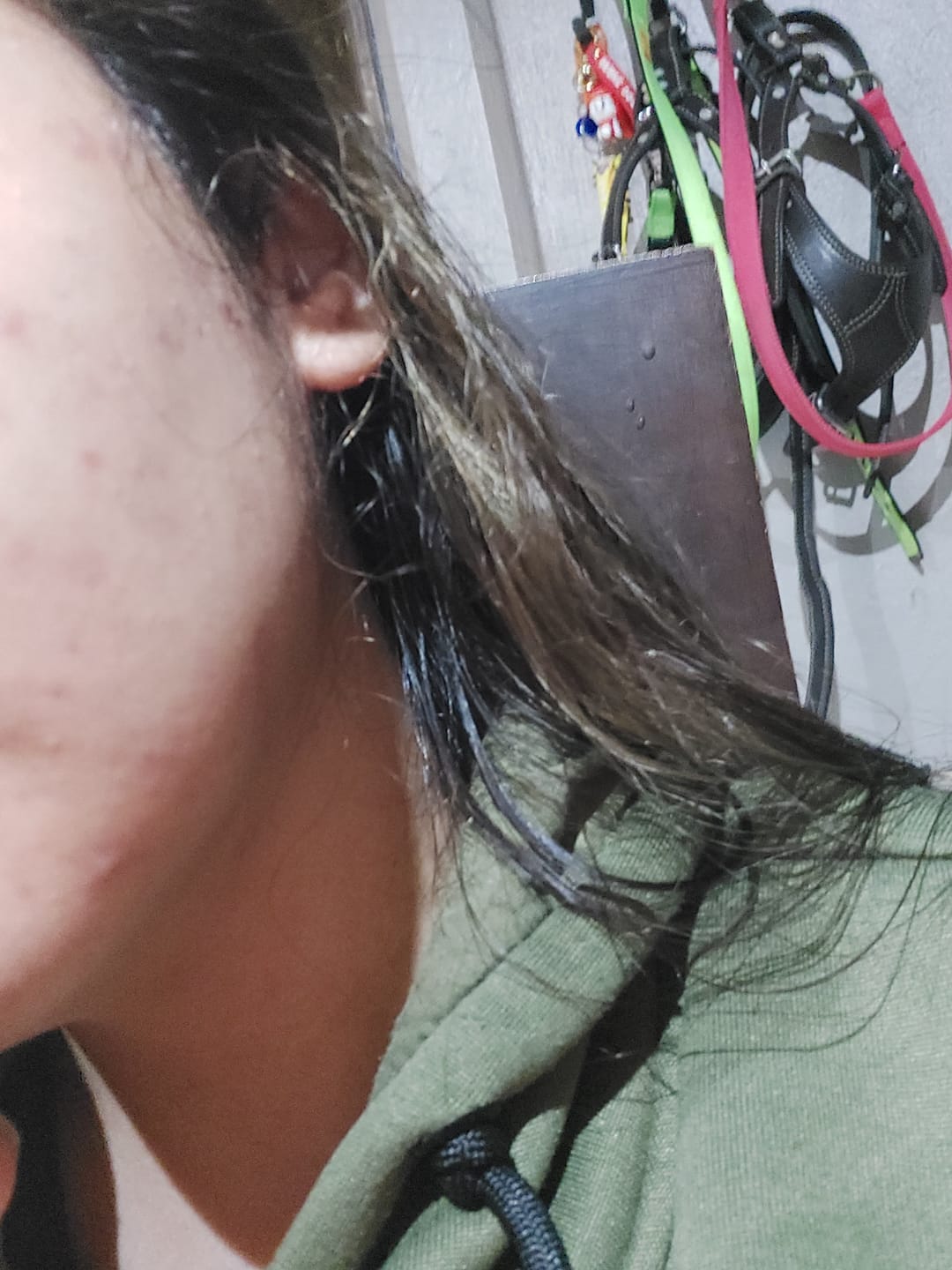 Customer photo review of Glycolic Acid 7% Exfoliating Toning Solution 240ml