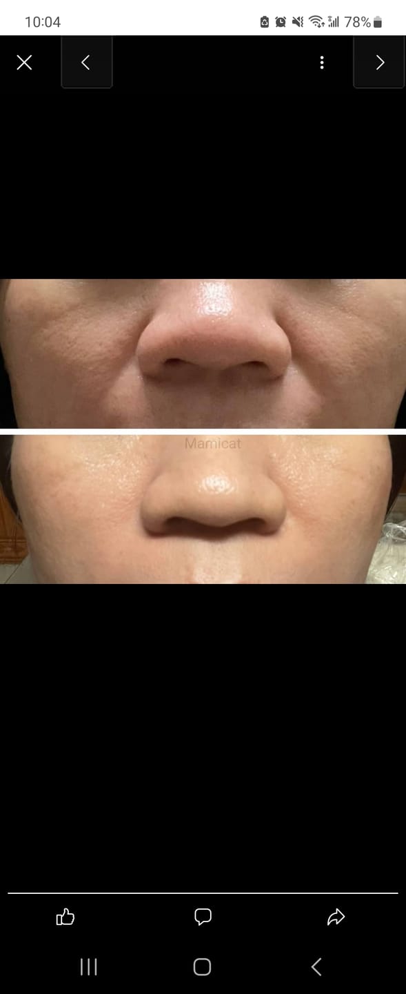 Customer photo review of Bravity Daily Volume Cream