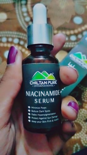 Customer photo review of Niacinamide Serum - Strengthens Skin's Barrier & Boosts Skin's Immunity
