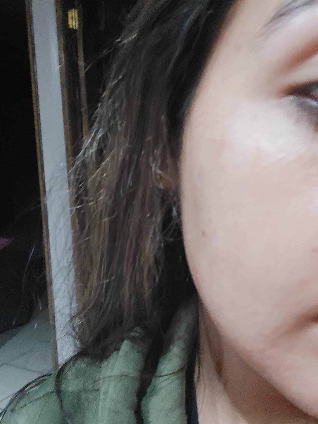 Customer photo review of Retinol 0.5% in Squalane