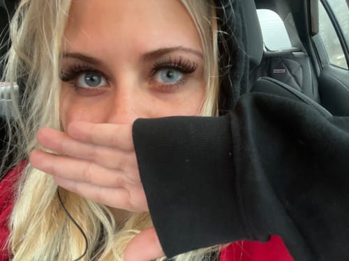 Customer photo review of Vegas Girl Contact Lenses(12 months of use)