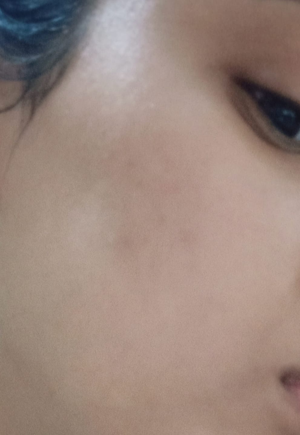 Customer photo review of VIT C GLOW BOOSTER - Vitamin Nectar Moisturizer