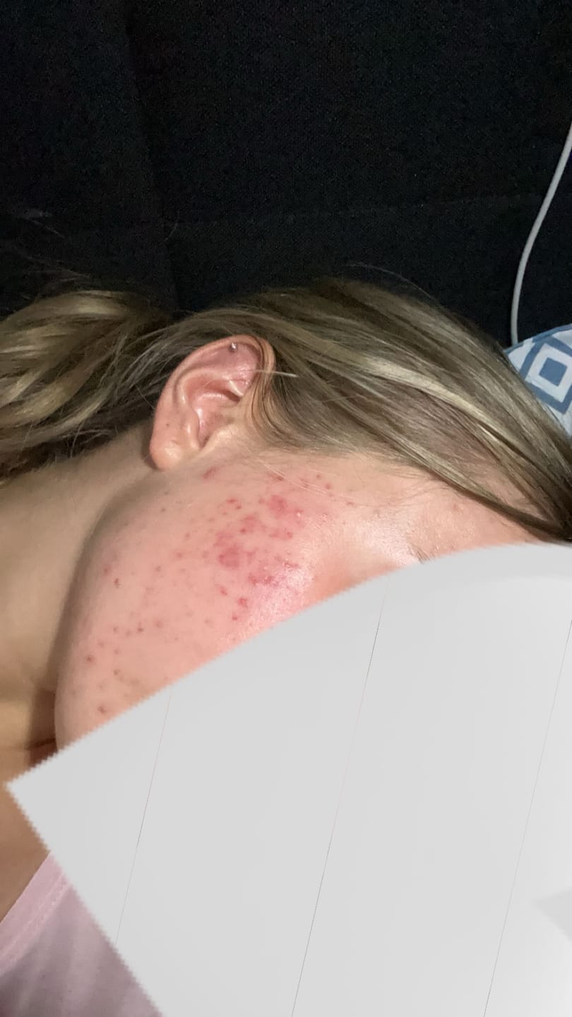 Customer photo review of Sleek Skin Serum 30ml