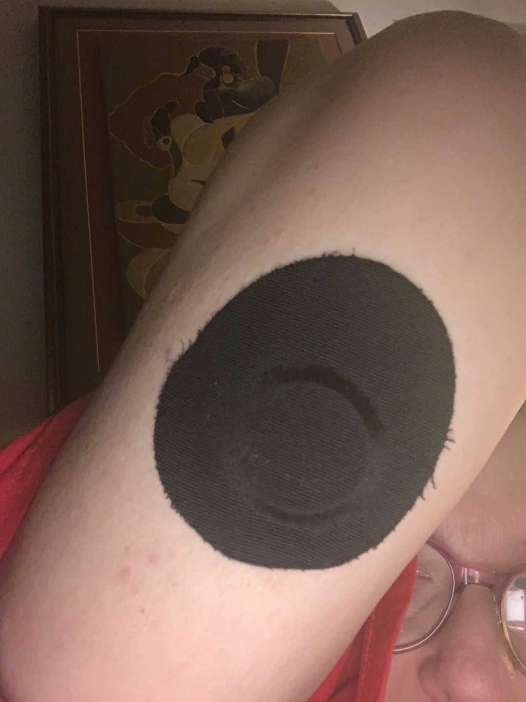 Customer photo review of Skin Grip Original - Freestyle Libre Adhesive Patches