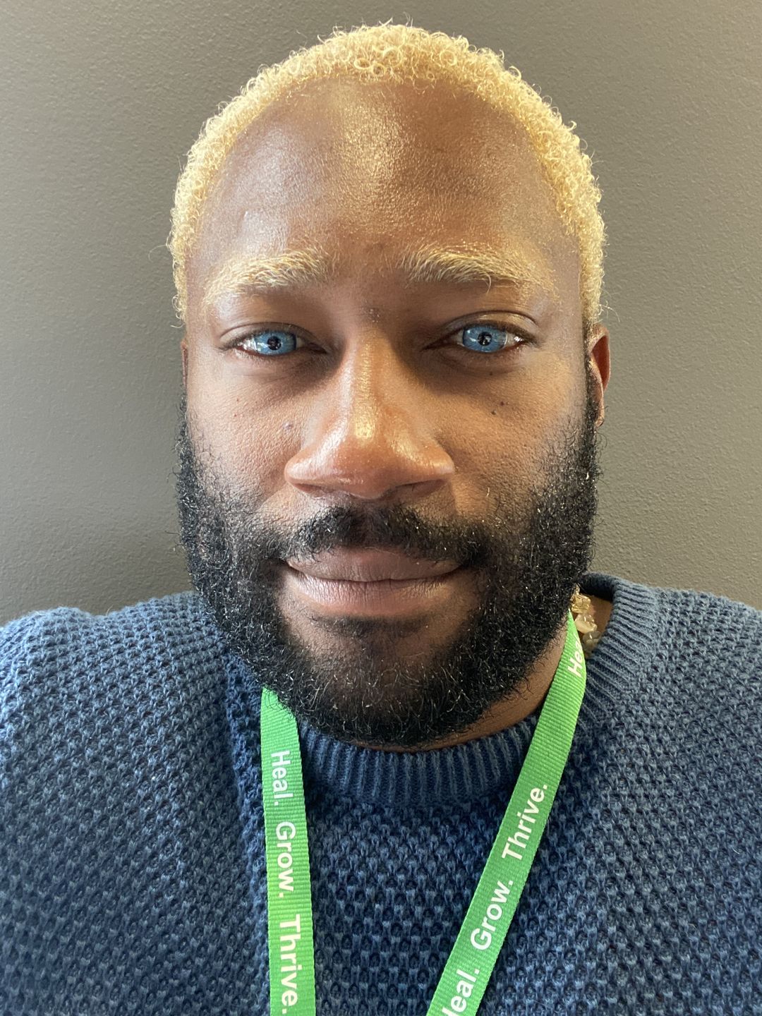 Customer photo review of New York Blue Prescription Coloured Contact Lenses