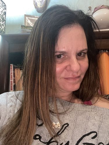 Customer photo review of WrinkleFix: Botox Membership Auto renew