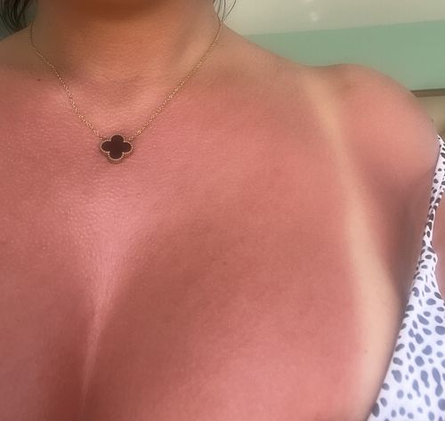 Customer photo review of 100% Natural & Organic Tanning Oil