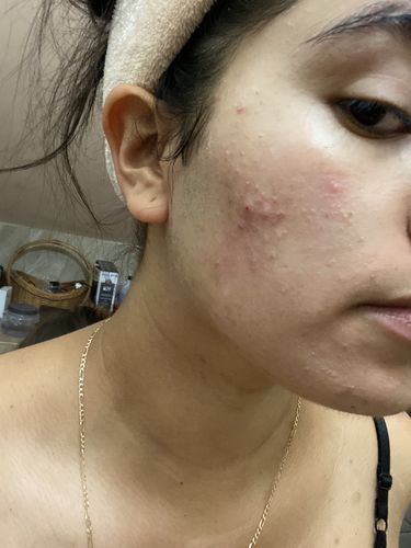 Customer photo review of Rutina Personalizada