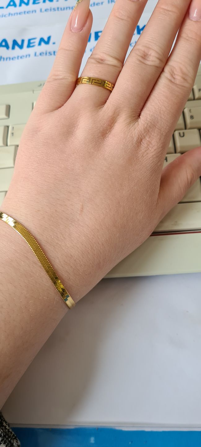 Customer photo review of Snake Skin Armband | 18K vergoldet