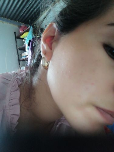 Customer photo review of Dermolimpiador acne control