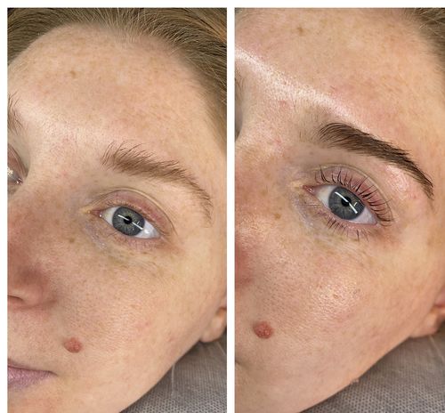 Customer photo review of BOO-Lash Basic kit