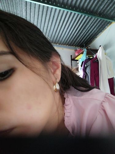 Customer photo review of Dermolimpiador acne control