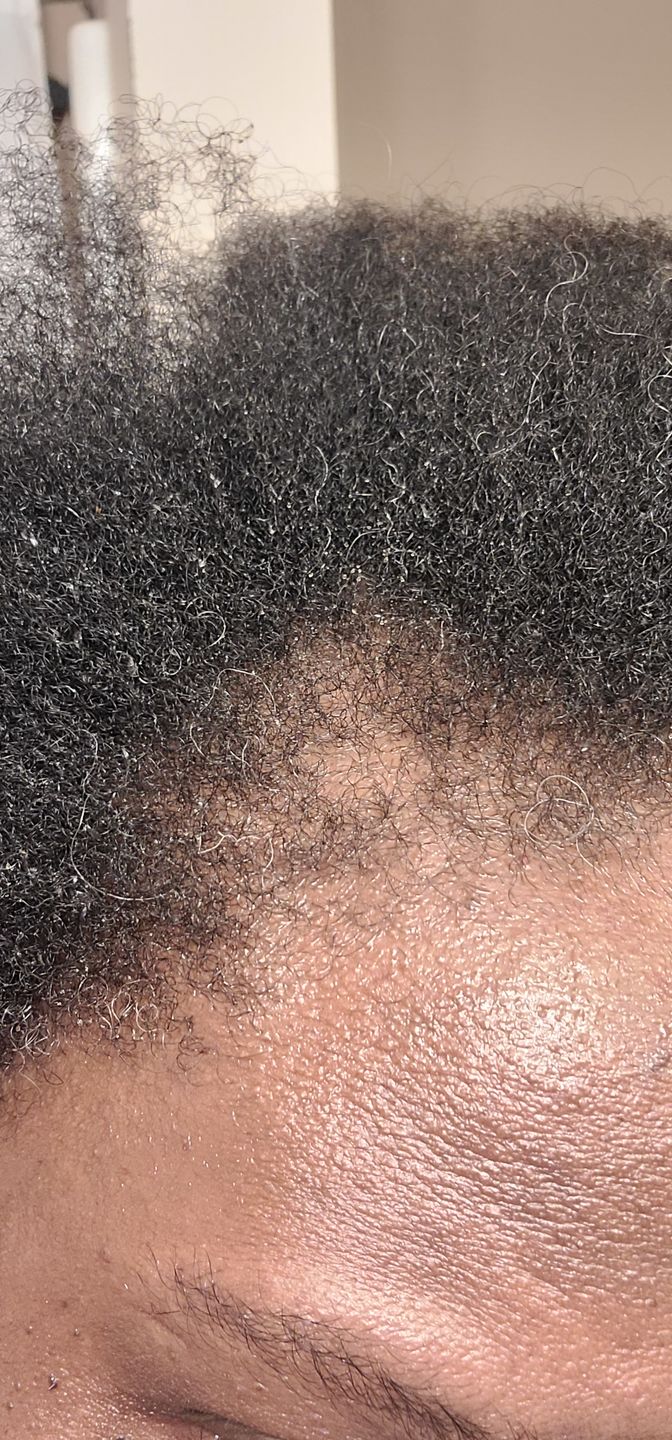 Customer photo review of Growth Serum for Curly Hair